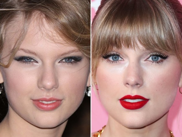 Gossip Alleges That Taylor Swift Has Undergone Plastic Surgery